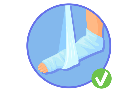 Hand in Plaster Cast: Medical Graphics & Illustrations