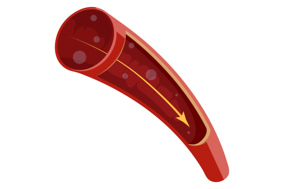 Human Artery Medical Illustration with B Graphics